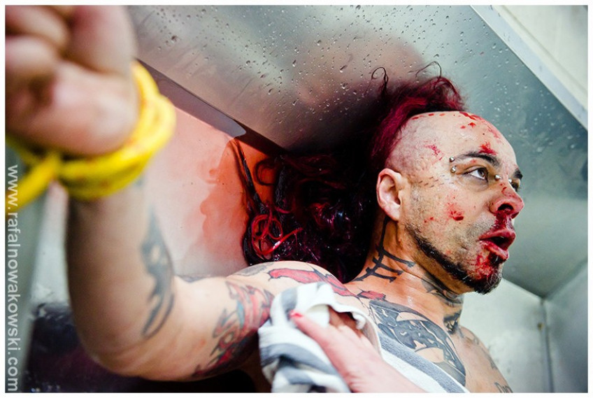 Glaca powraca: sprawdź prowokacyjny klip „Botox”!